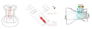 KAVACH (Quant PPH – A Low Cost PPH Monitoring Diaper)